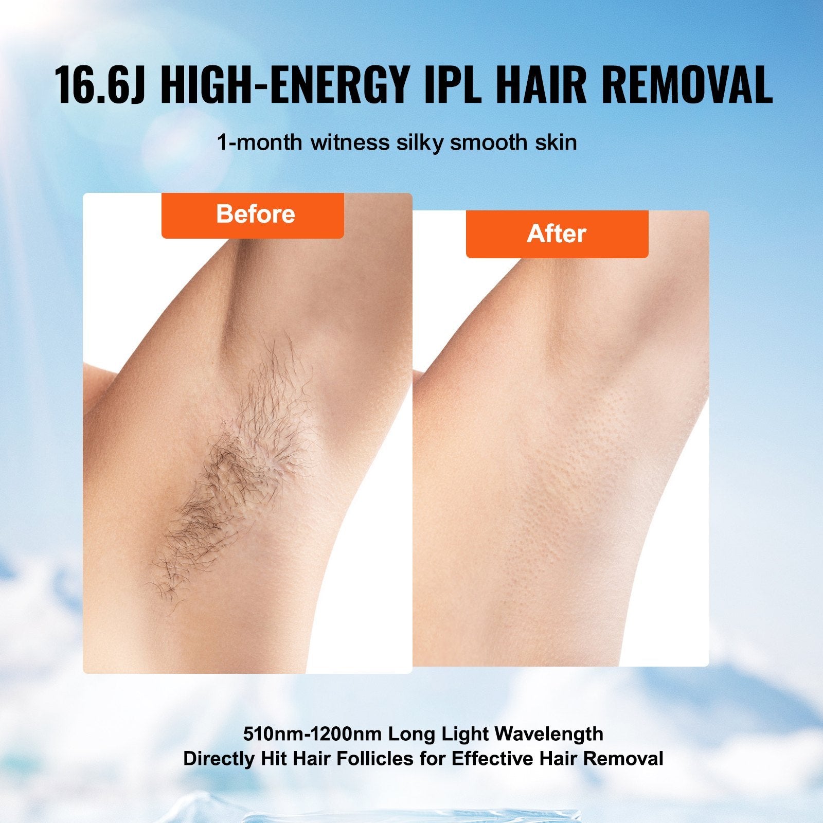 IPL at-home hair removal